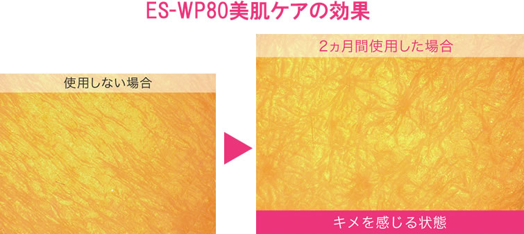 家庭用脱毛器_光エステのES-WP80とは │ ゆるダツ