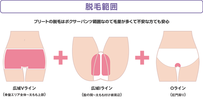 プリートのVIOの脱毛範囲